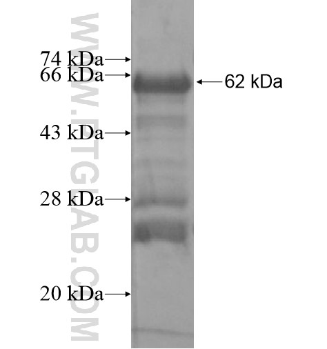 FAM131C fusion protein Ag15392 SDS-PAGE FAM131C fusion protein Ag15392 SDS-PAGE