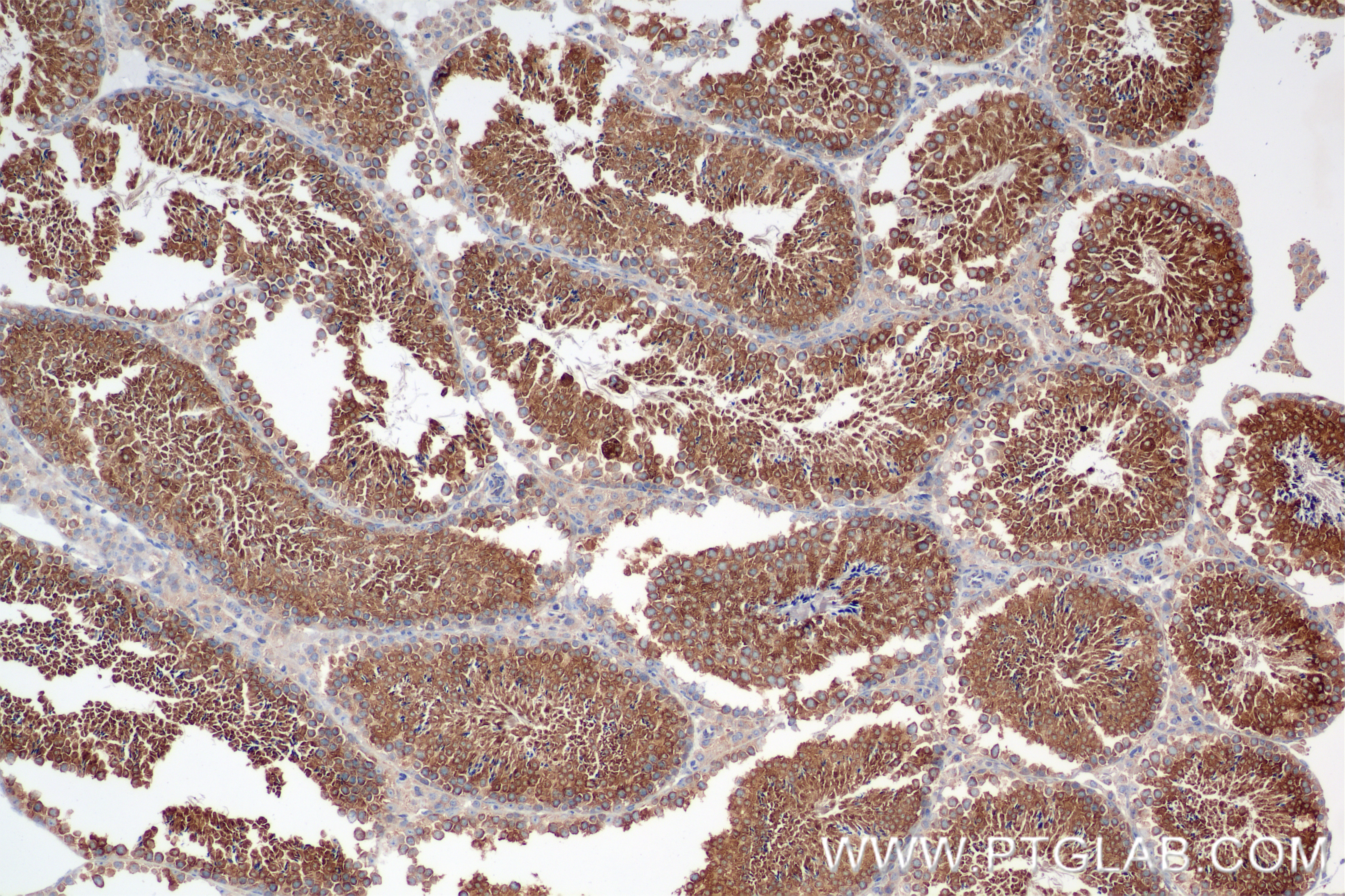IHC staining of mouse testis using 85791-4-RR (same clone as 85791-4-PBS)