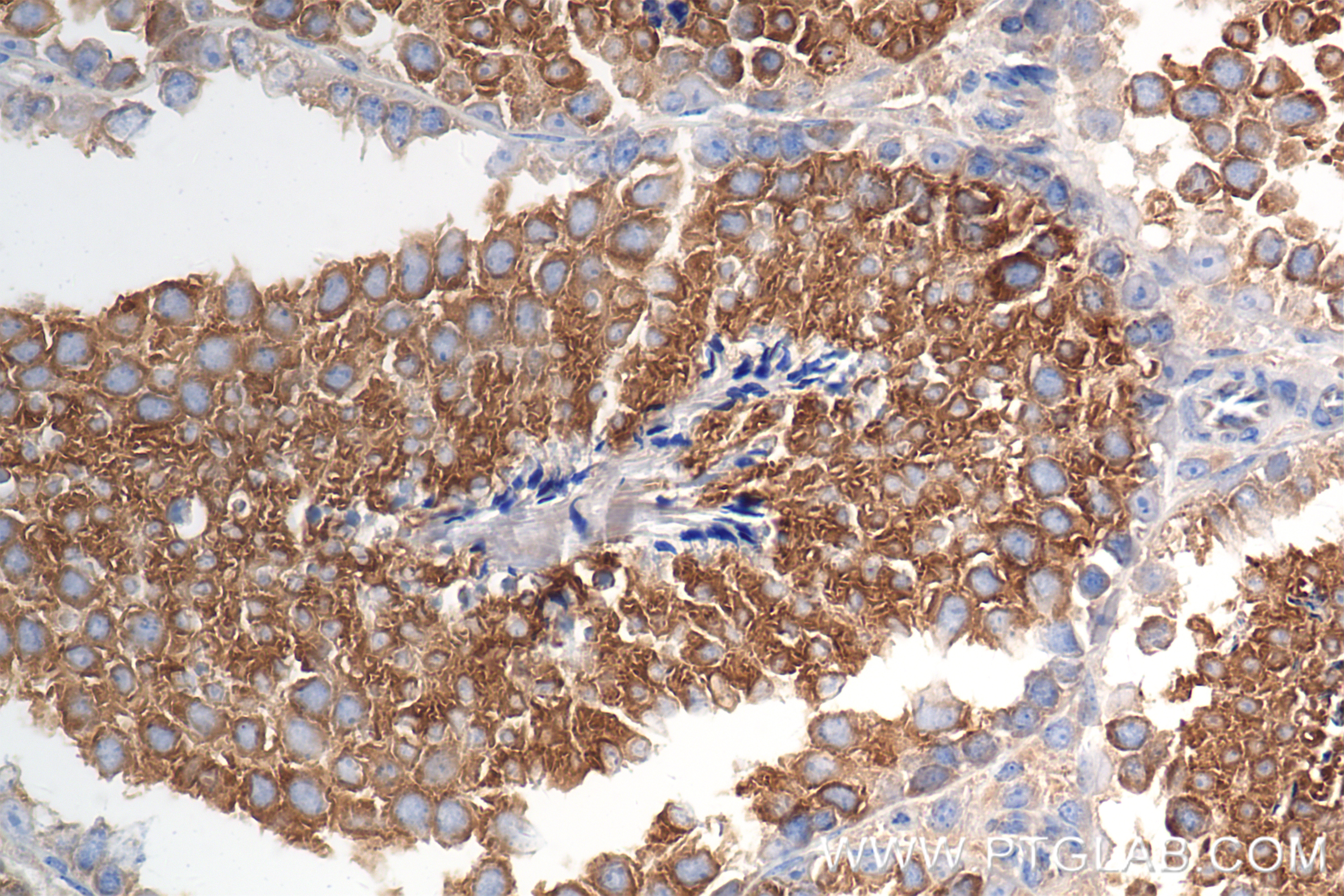 IHC staining of mouse testis using 85791-4-RR (same clone as 85791-4-PBS)