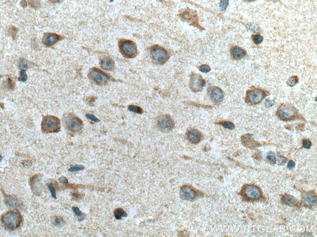 IHC staining of mouse brain using 21537-1-AP