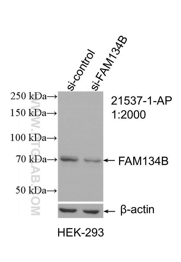 WB analysis of HEK-293 using 21537-1-AP