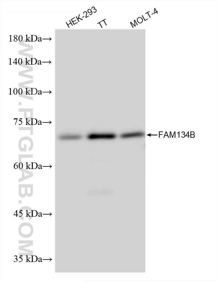 WB analysis using 84773-3-RR (same clone as 84773-3-PBS)