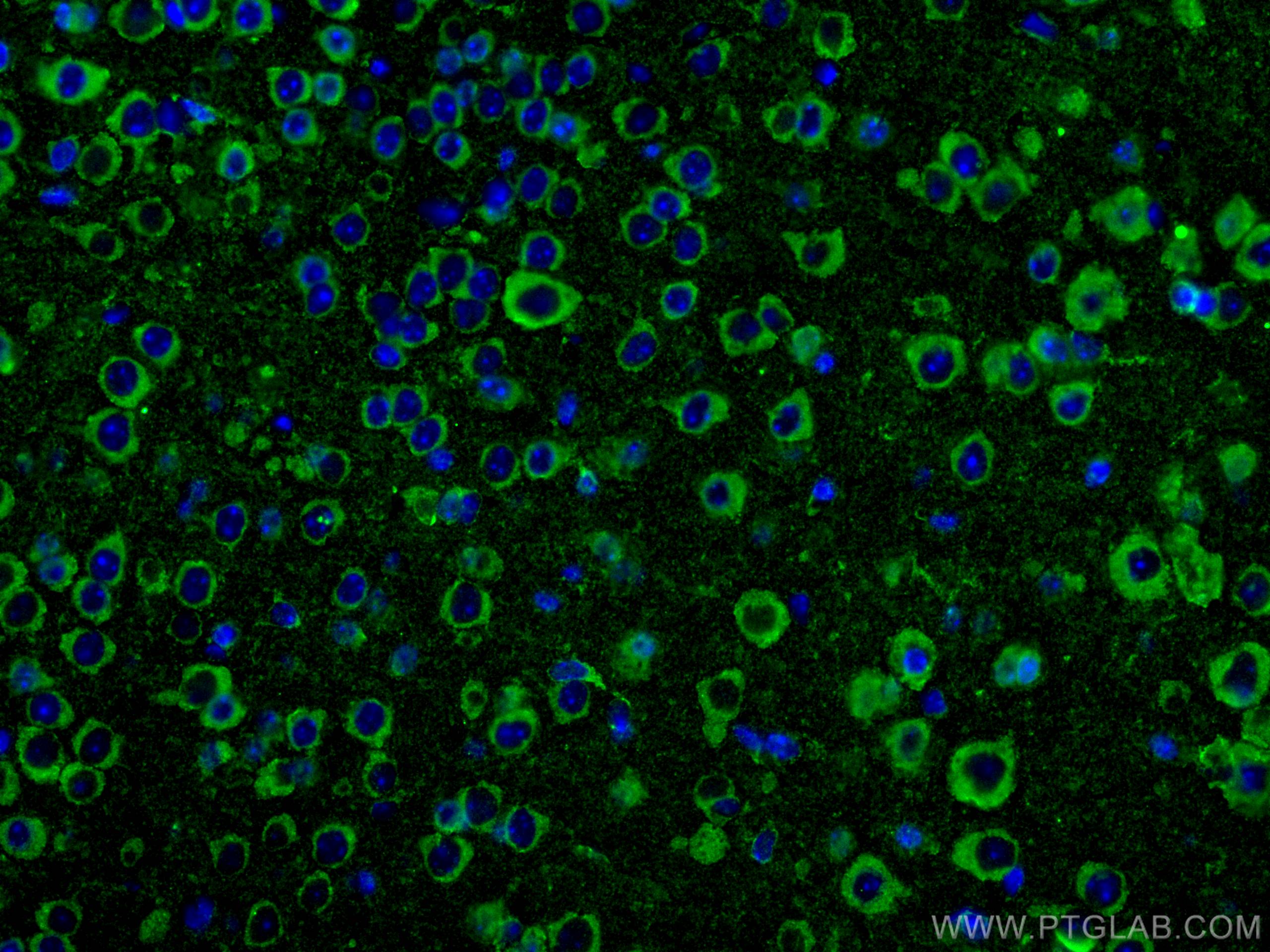 IF Staining of mouse brain using 28061-1-AP