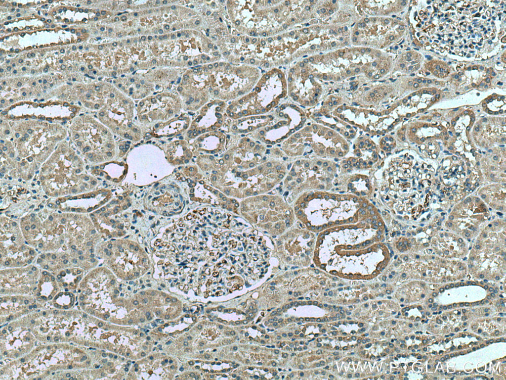 IHC staining of human kidney using 28061-1-AP