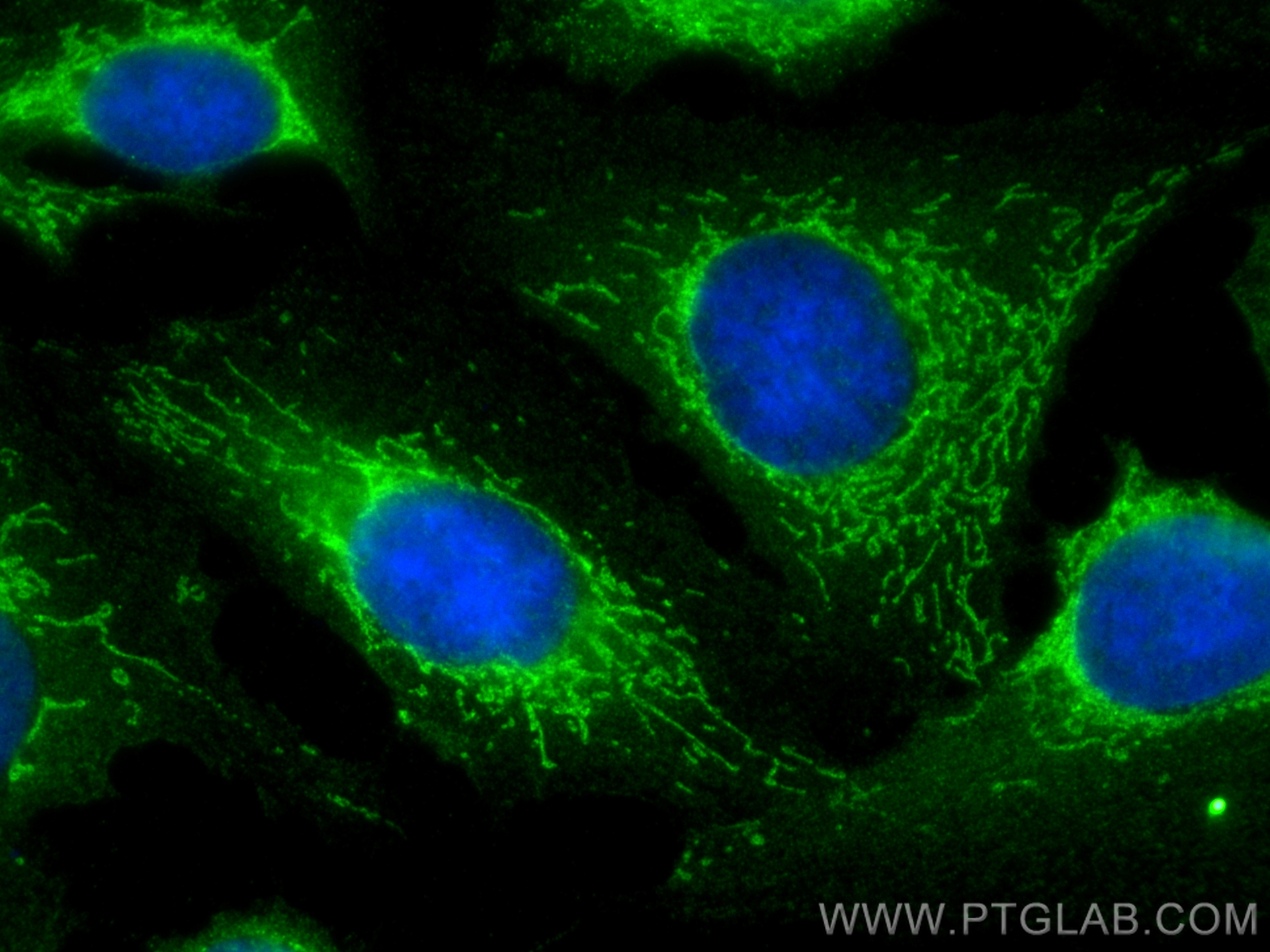 IF Staining of U2OS using 30845-1-AP