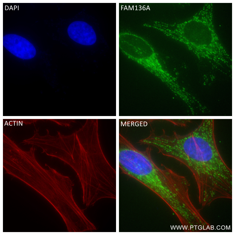IF Staining of HeLa using 84150-2-RR (same clone as 84150-2-PBS)