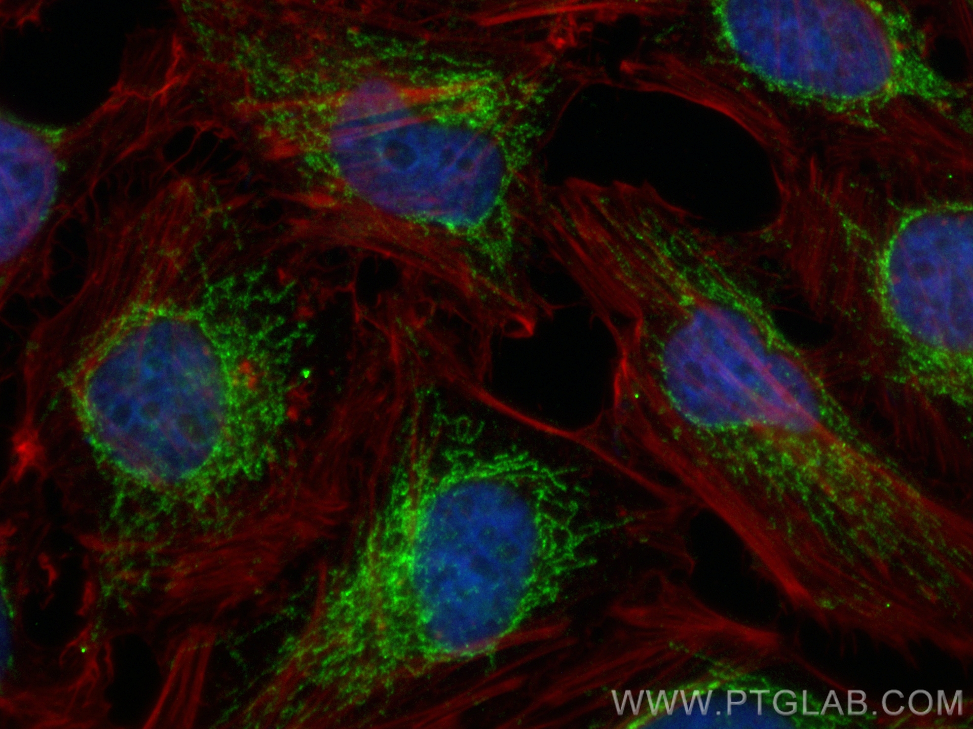 IF Staining of HeLa using CL488-84150-2