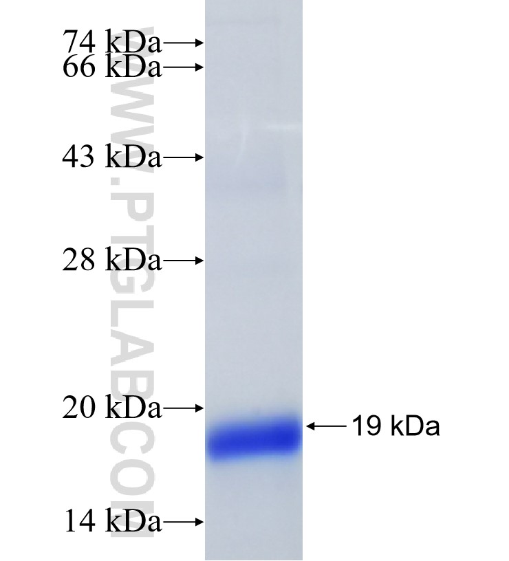 FAM136A fusion protein Ag35049 SDS-PAGE FAM136A fusion protein Ag35049 SDS-PAGE