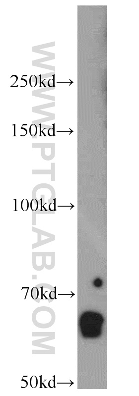 WB analysis of mouse kidney using 55401-1-AP