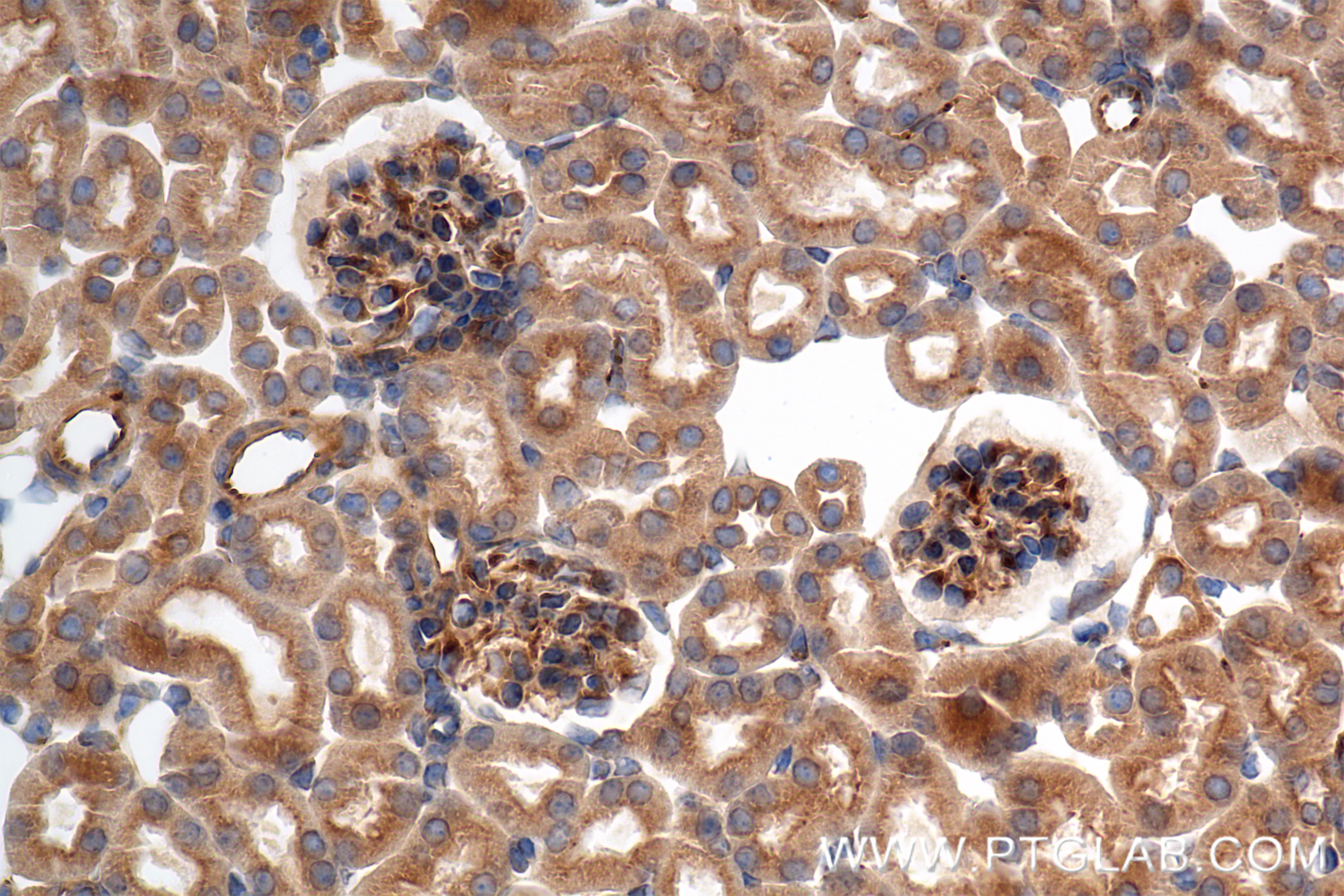 Immunohistochemical analysis of paraffin-embedded mouse kidney tissue slide using 85092-1-PBS (FAM13A antibody) at dilution of 1:1000 (under 40x lens). Heat mediated antigen retrieval with Tris-EDTA buffer (pH 9.0). IHC staining of mouse kidney using 85092-1-PBS