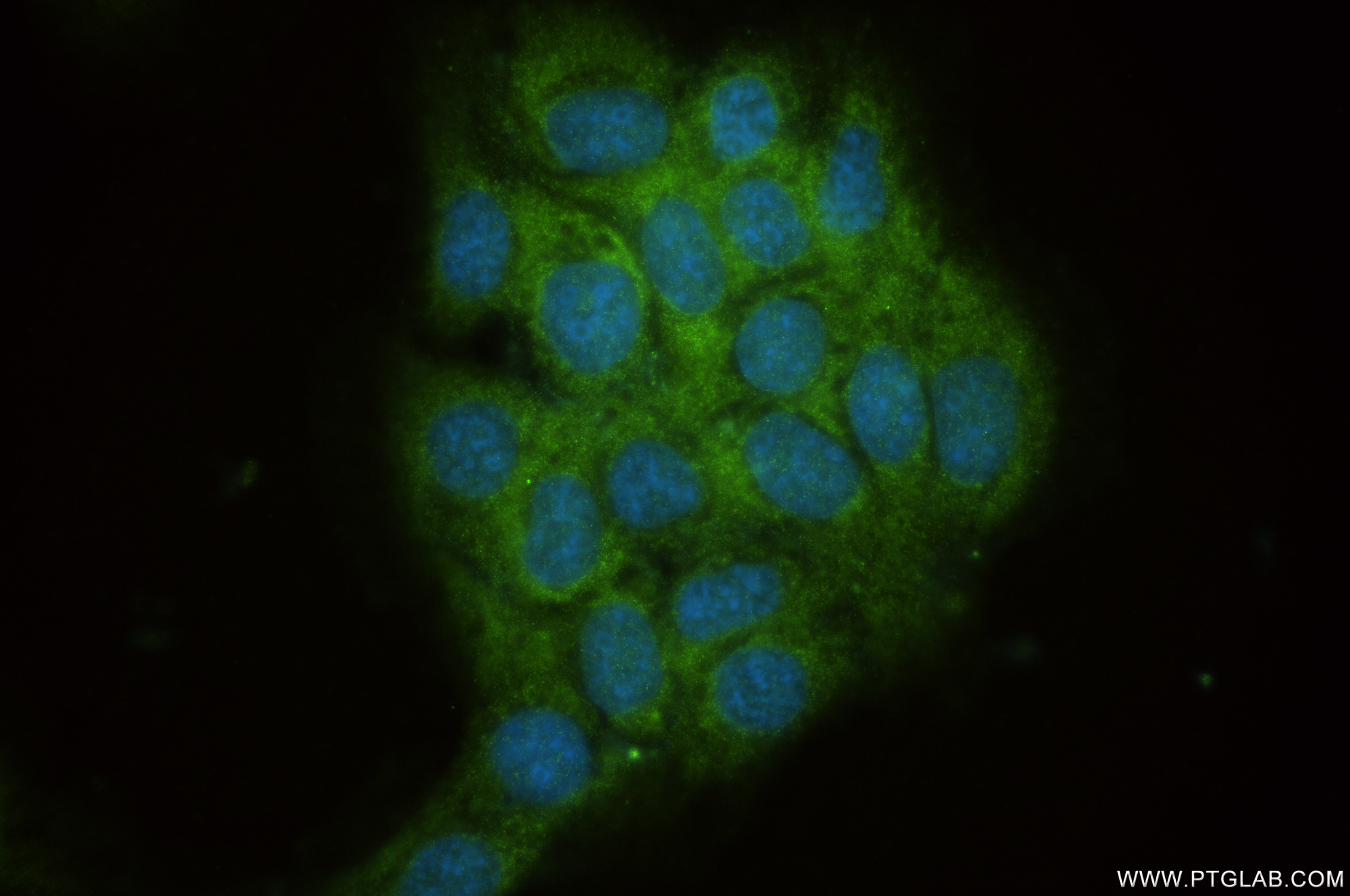 IF Staining of A431 using 85092-1-RR
