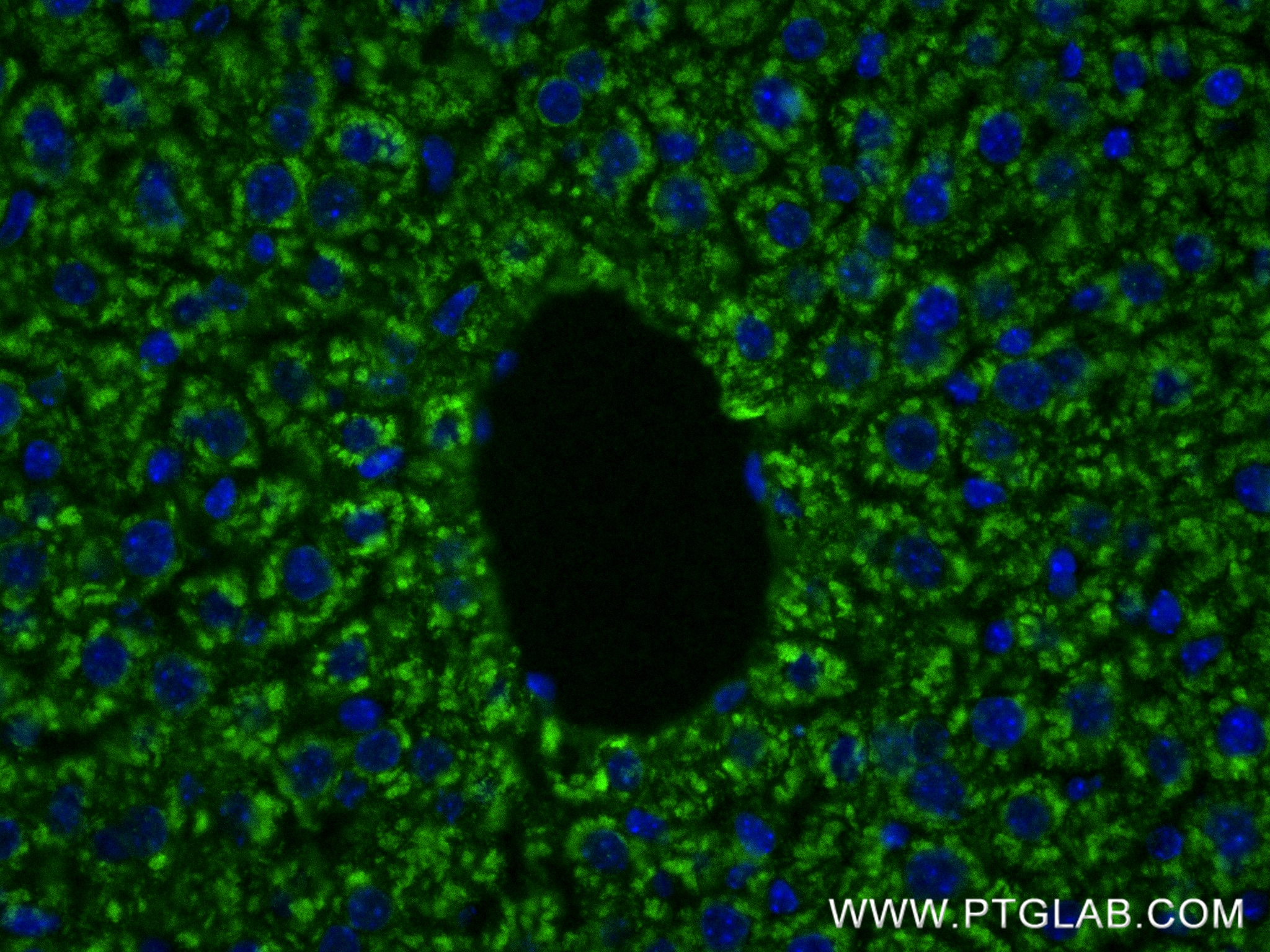 IF Staining of mouse liver using 85092-1-RR