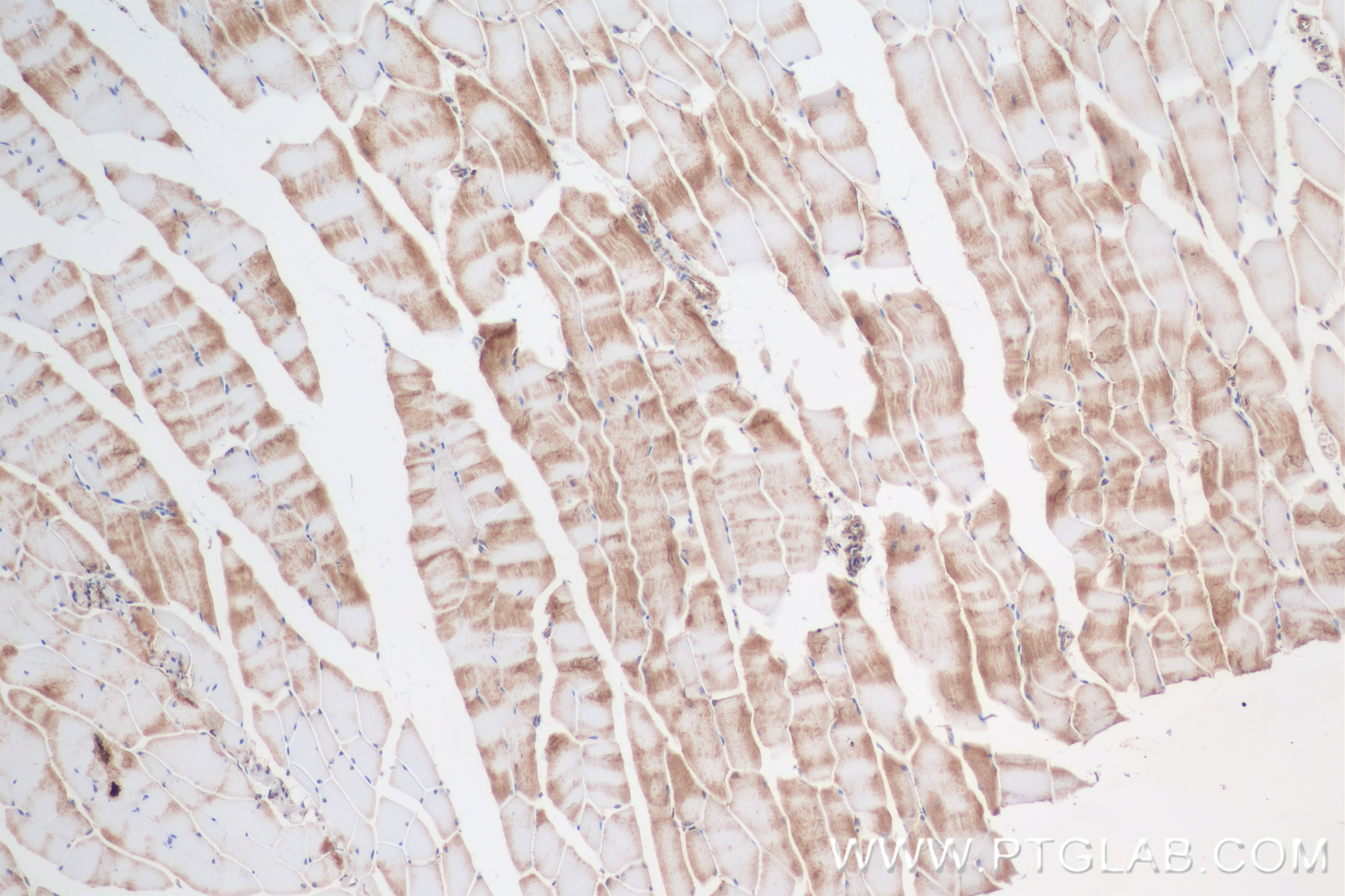 IHC staining of mouse skeletal muscle using 85092-1-RR