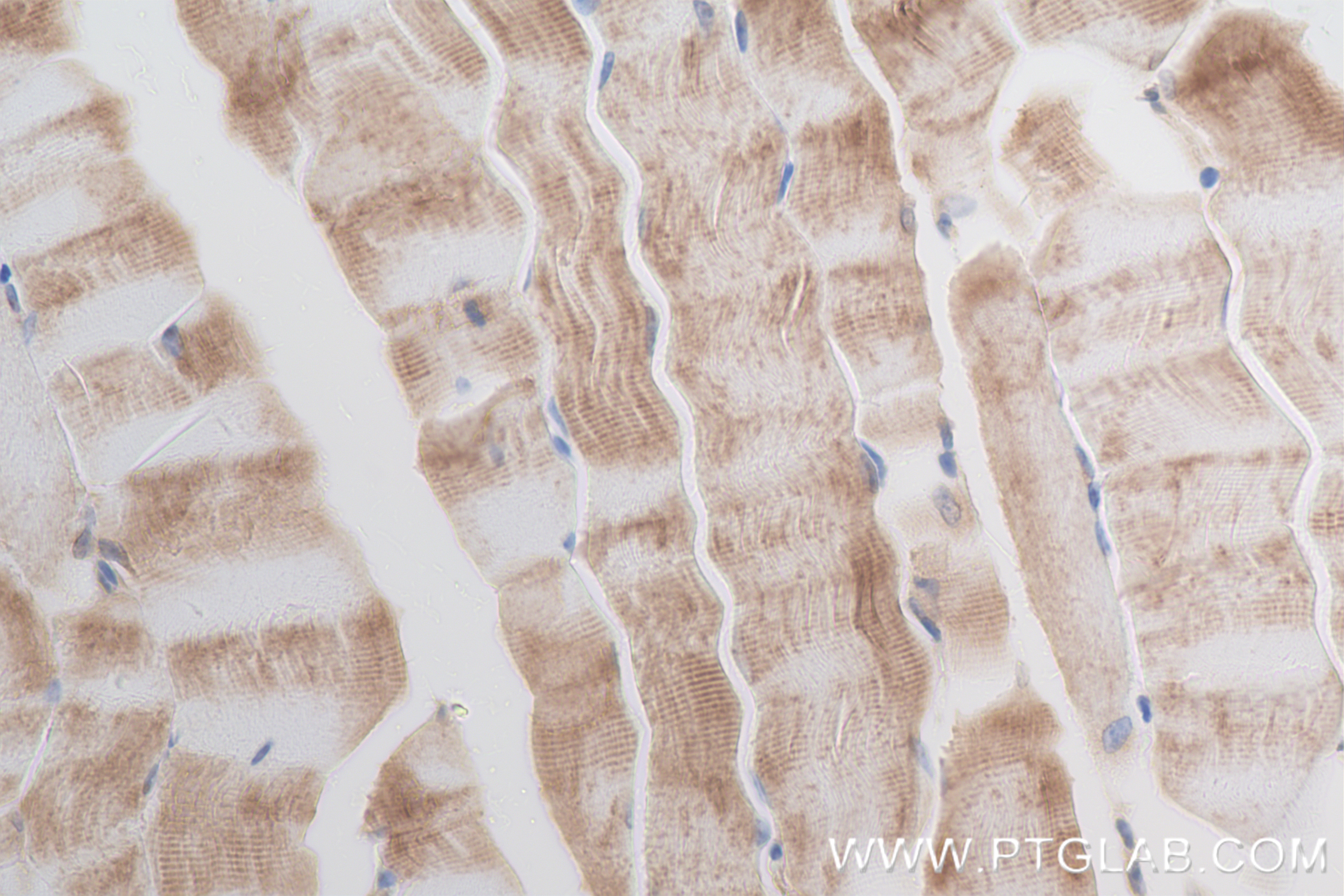 IHC staining of mouse skeletal muscle using 85092-1-RR