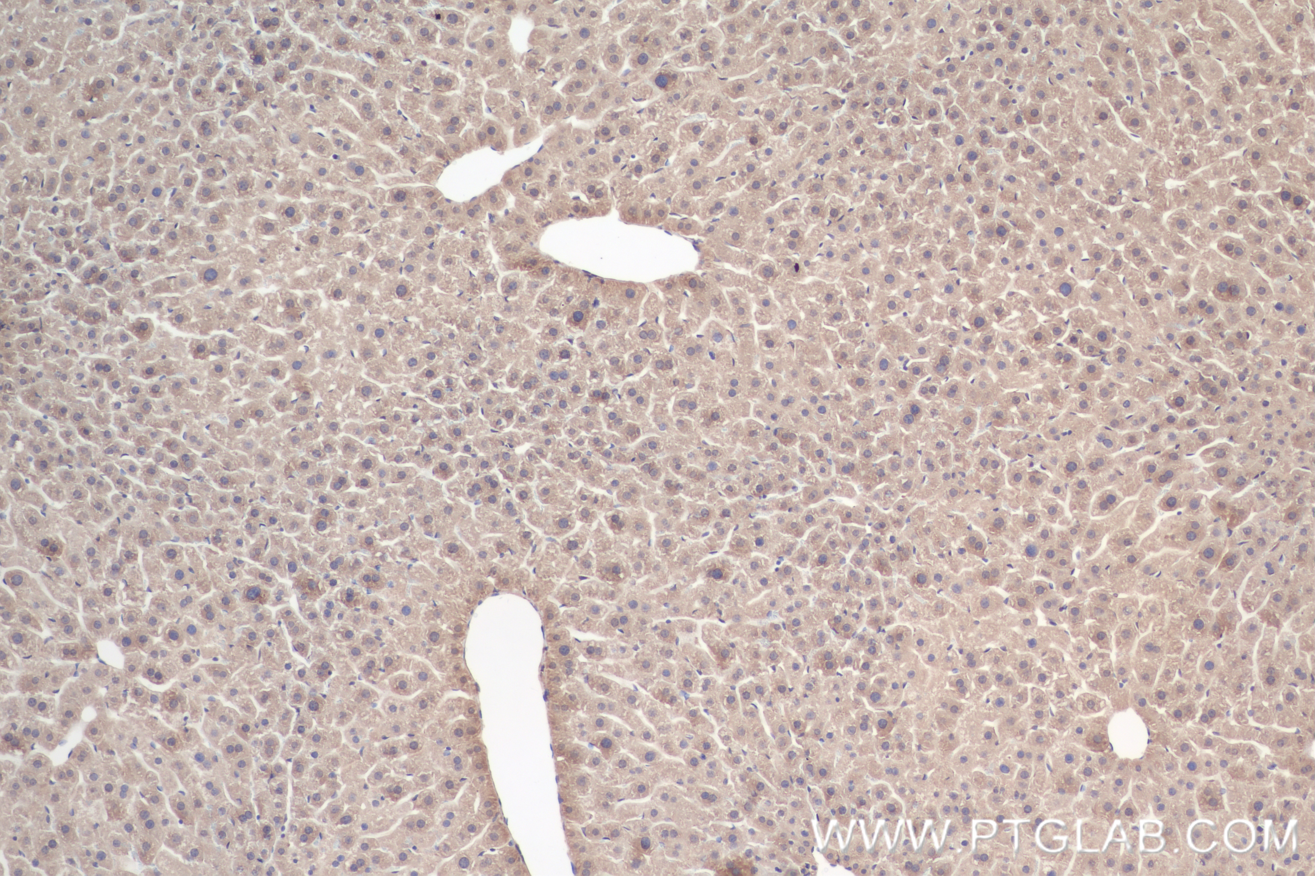 IHC staining of mouse liver using 85092-1-RR