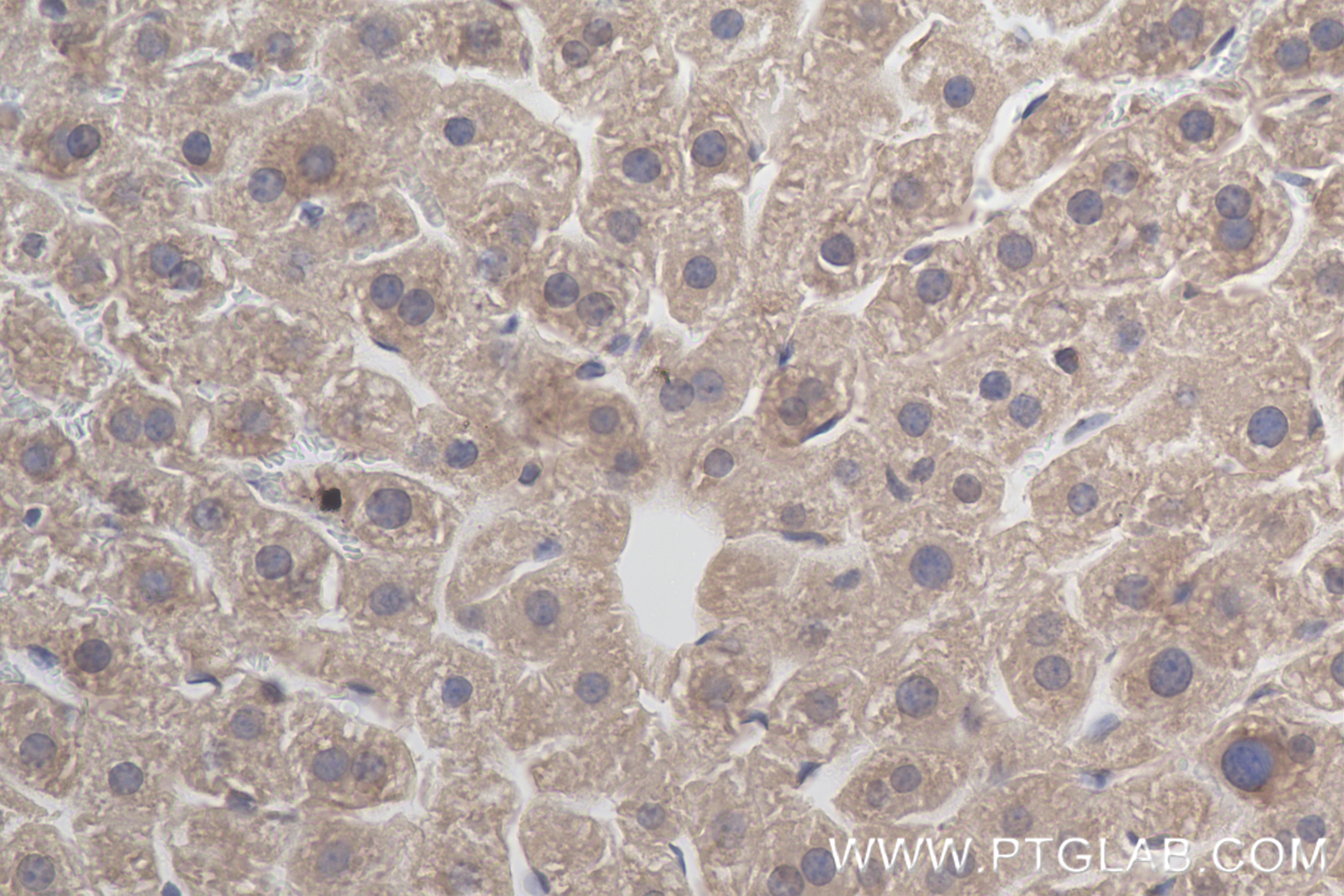 IHC staining of mouse liver using 85092-1-RR