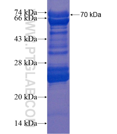 FAM154A fusion protein Ag19980 SDS-PAGE FAM154A fusion protein Ag19980 SDS-PAGE