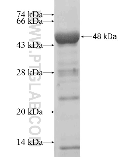 FAM154A fusion protein Ag19986 SDS-PAGE FAM154A fusion protein Ag19986 SDS-PAGE