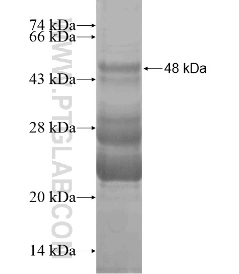 FAM155B fusion protein Ag20423 SDS-PAGE FAM155B fusion protein Ag20423 SDS-PAGE
