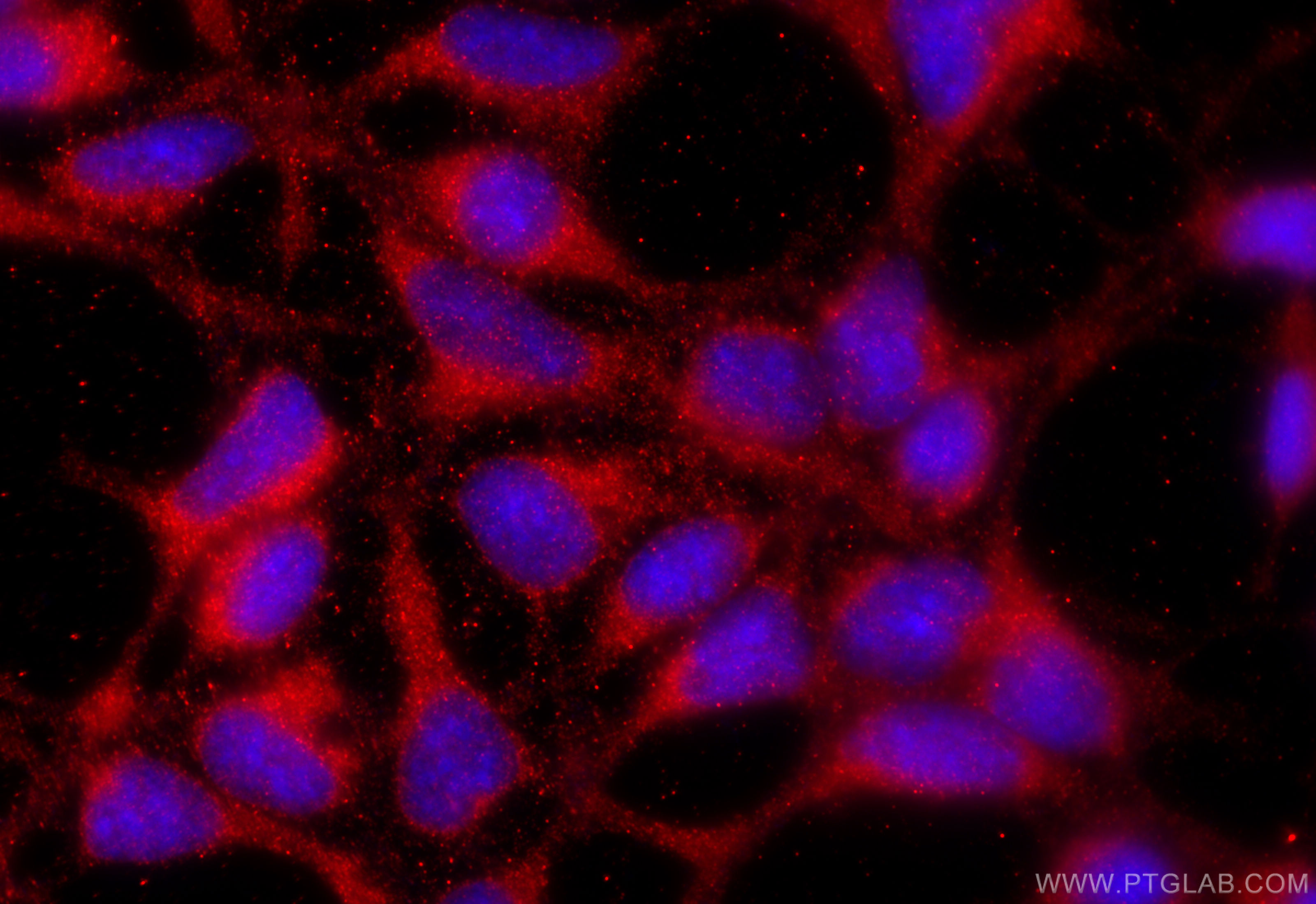 IF Staining of HEK-293 using 23919-1-AP