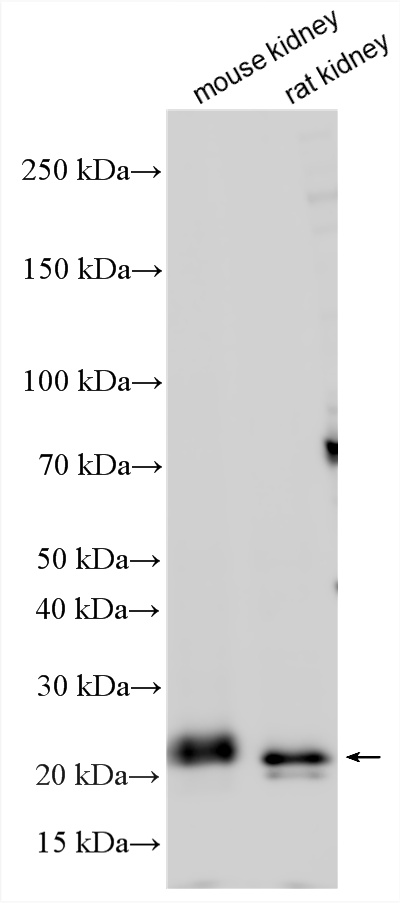 WB analysis using 23919-1-AP