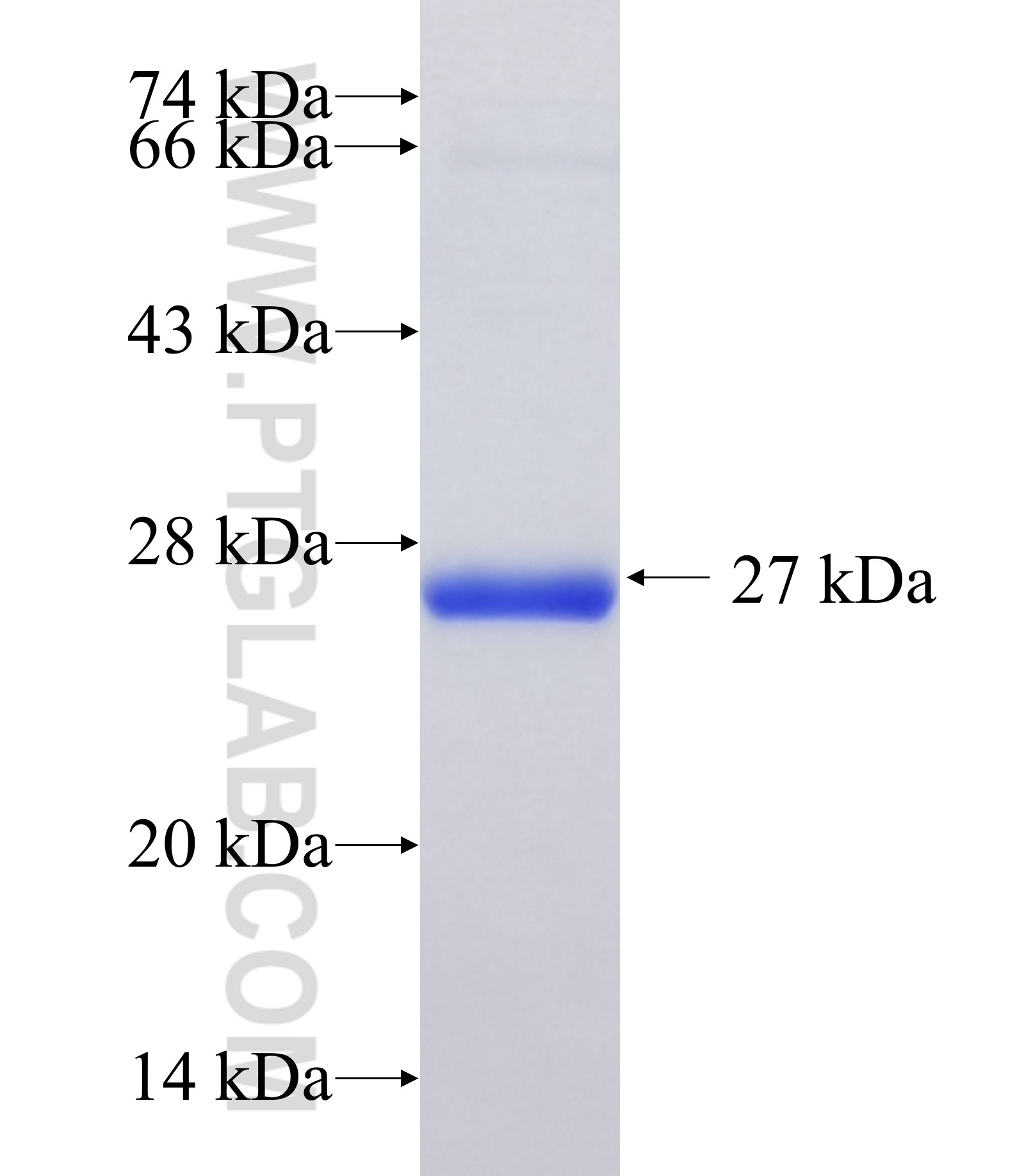 FAM160A2 fusion protein Ag36302 SDS-PAGE FAM160A2 fusion protein Ag36302 SDS-PAGE