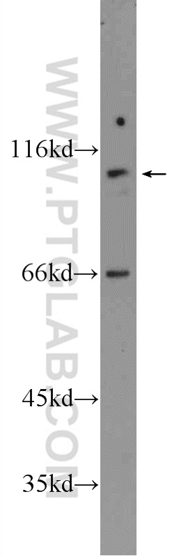 WB analysis of PC-3 using 25388-1-AP