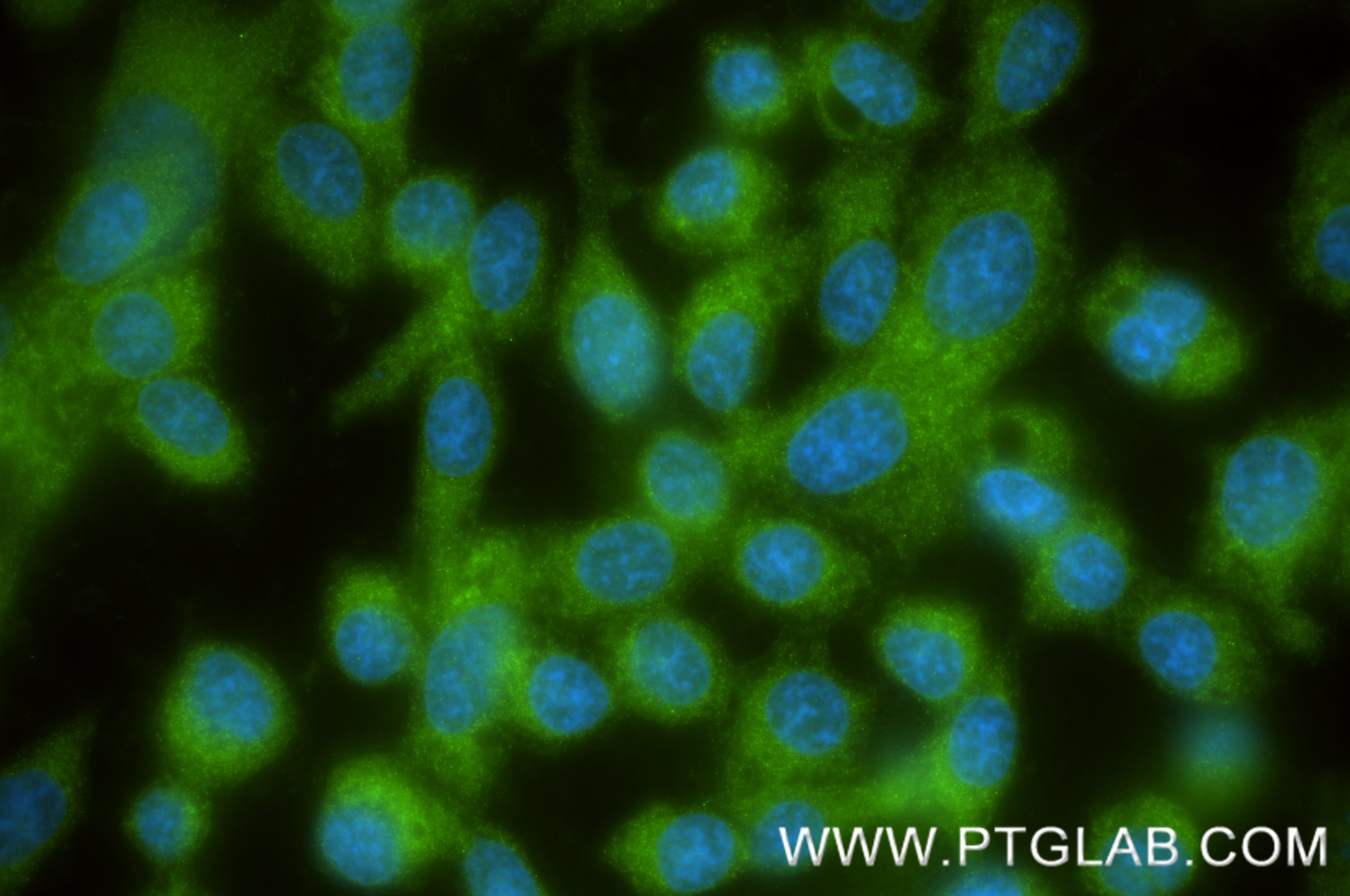 IF Staining of PC-3 using 86980-1-RR (same clone as 86980-1-PBS) IF Staining of PC-3 using 86980-1-RR (same clone as 86980-1-PBS)
