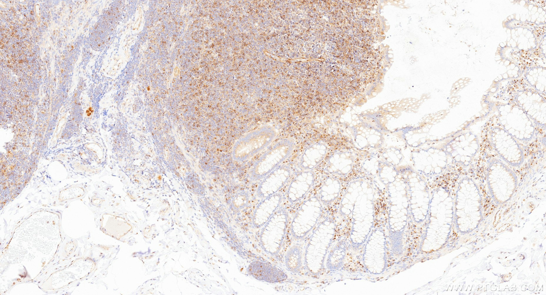 IHC staining of human colon using 86980-1-RR (same clone as 86980-1-PBS) IHC staining of human colon using 86980-1-RR (same clone as 86980-1-PBS)