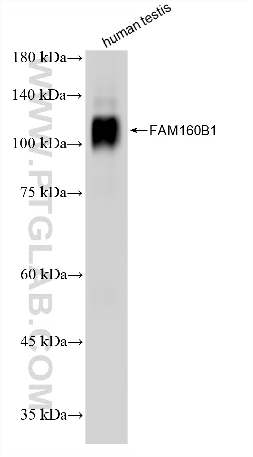 WB analysis of human testis using 86980-1-RR (same clone as 86980-1-PBS) WB analysis of human testis using 86980-1-RR (same clone as 86980-1-PBS)