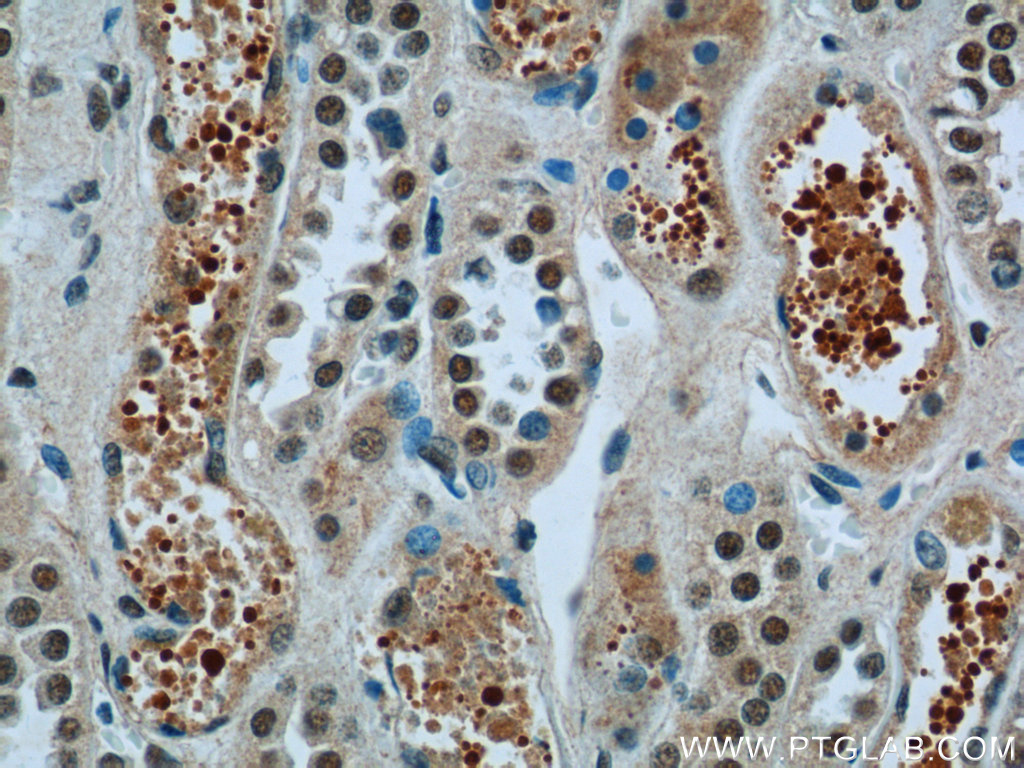 IHC staining of human kidney using 20520-1-AP