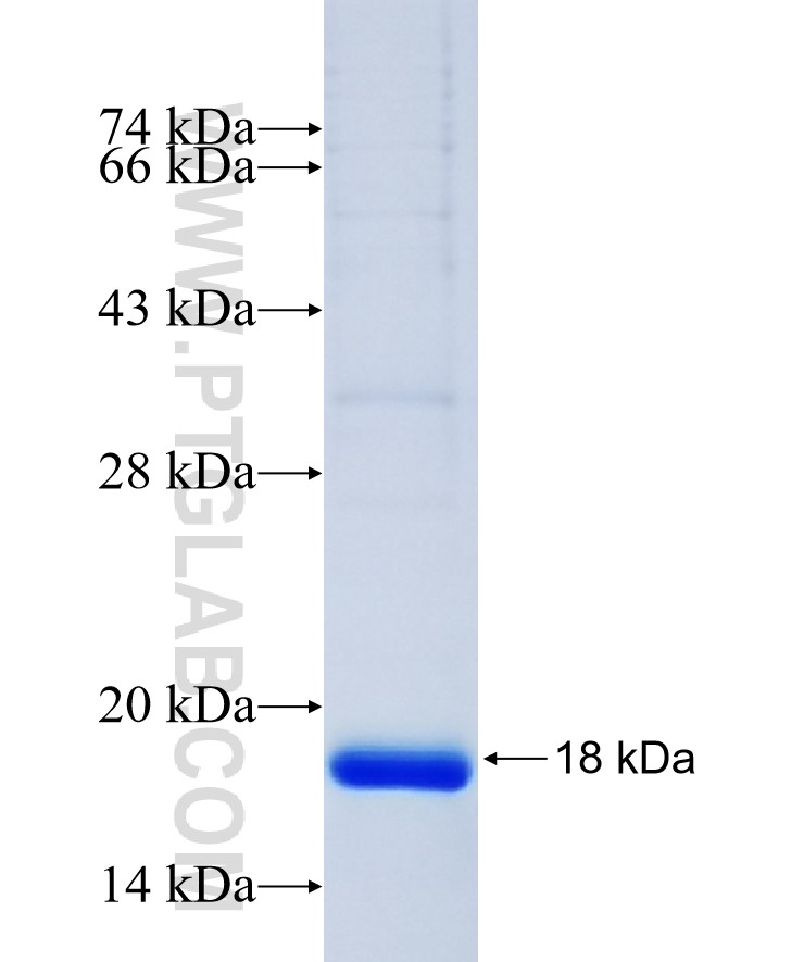 FAM167B fusion protein Ag14873 SDS-PAGE FAM167B fusion protein Ag14873 SDS-PAGE