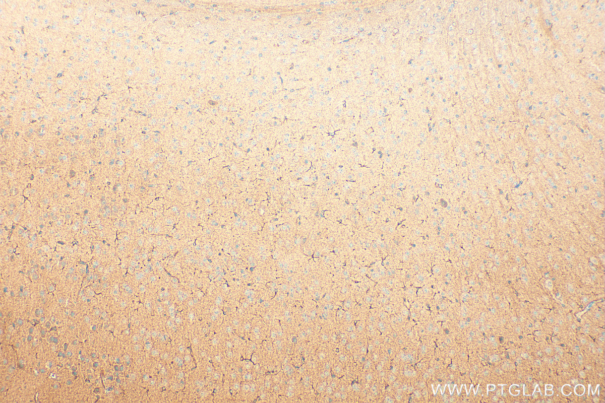 Immunohistochemical analysis of paraffin-embedded mouse brain tissue slide using 20836-1-AP (FAM171A2 antibody) at dilution of 1:400 (under 10x lens). Heat mediated antigen retrieval with Tris-EDTA buffer (pH 9.0). IHC staining of mouse brain using 20836-1-AP