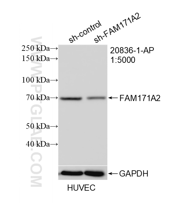 WB result of FAM171A2 antibody (20836-1-AP; 1:5000; incubated at room temperature for 1.5 hours) with sh-Control and sh-FAM171A2 transfected HUVEC cells. WB analysis of HUVEC using 20836-1-AP