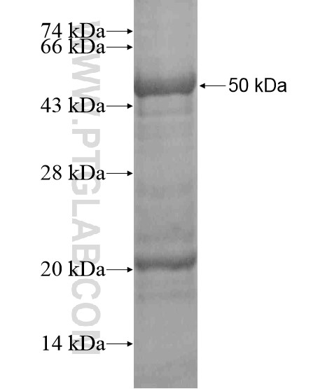 FAM172A fusion protein Ag20426 SDS-PAGE FAM172A fusion protein Ag20426 SDS-PAGE