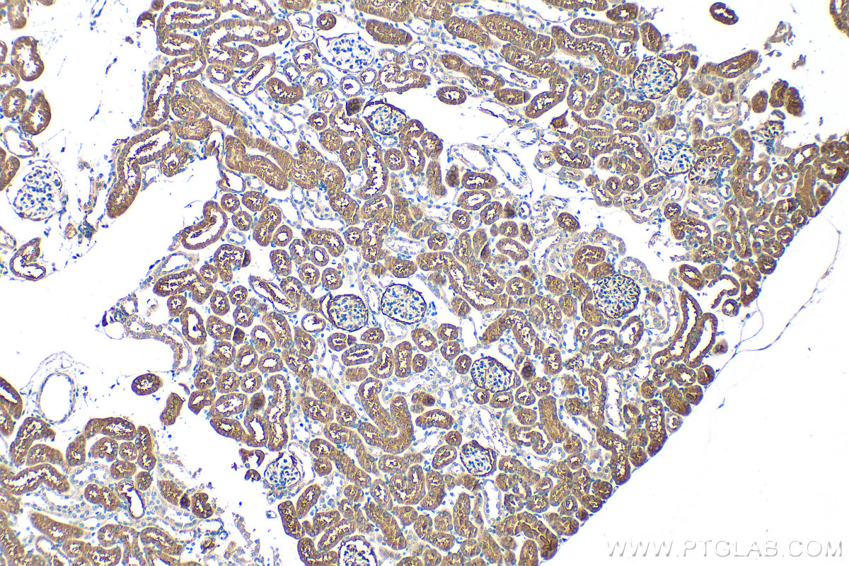 IHC staining of mouse kidney using 32901-1-AP