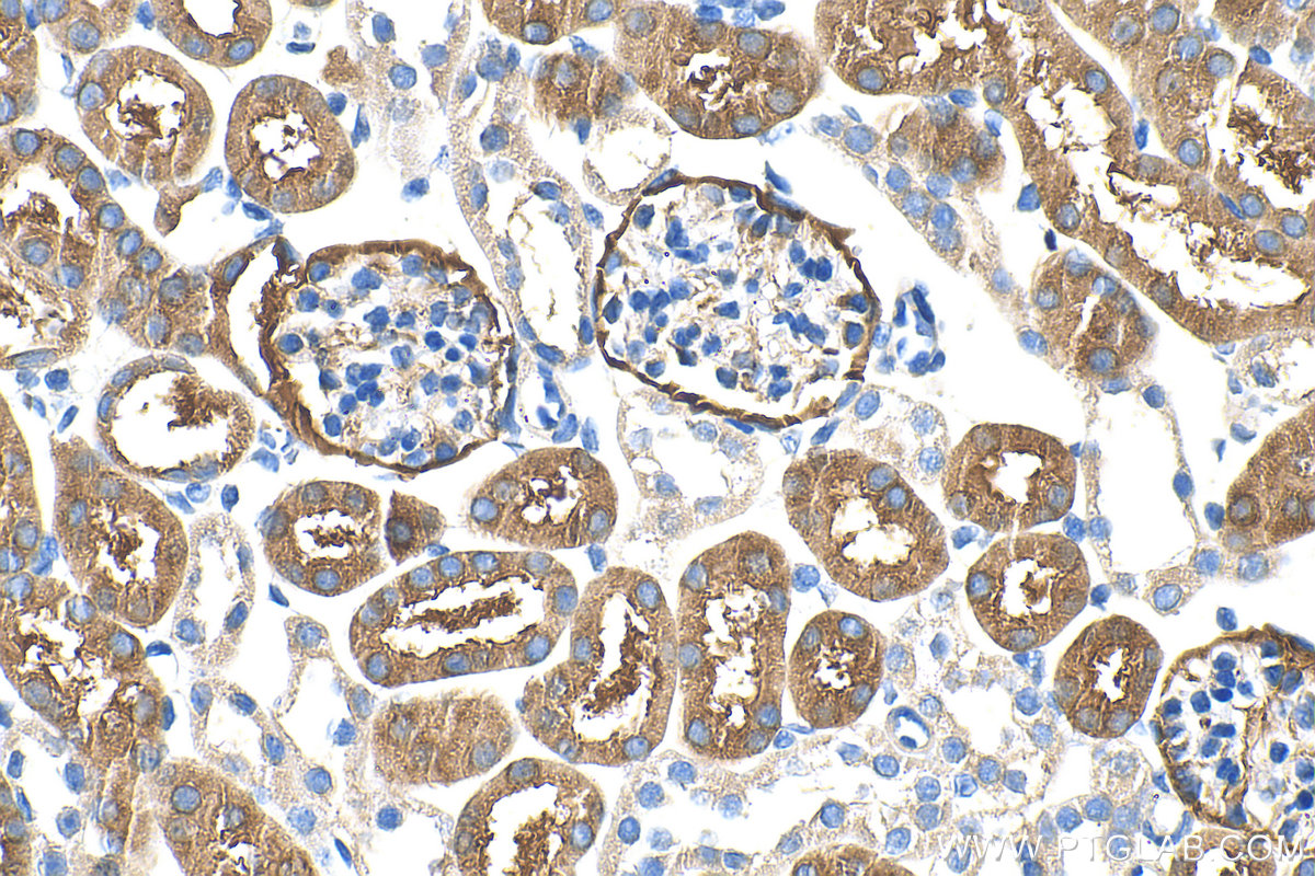 IHC staining of mouse kidney using 32901-1-AP