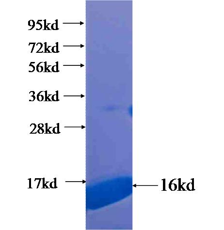 FAM174A fusion protein Ag20494 SDS-PAGE