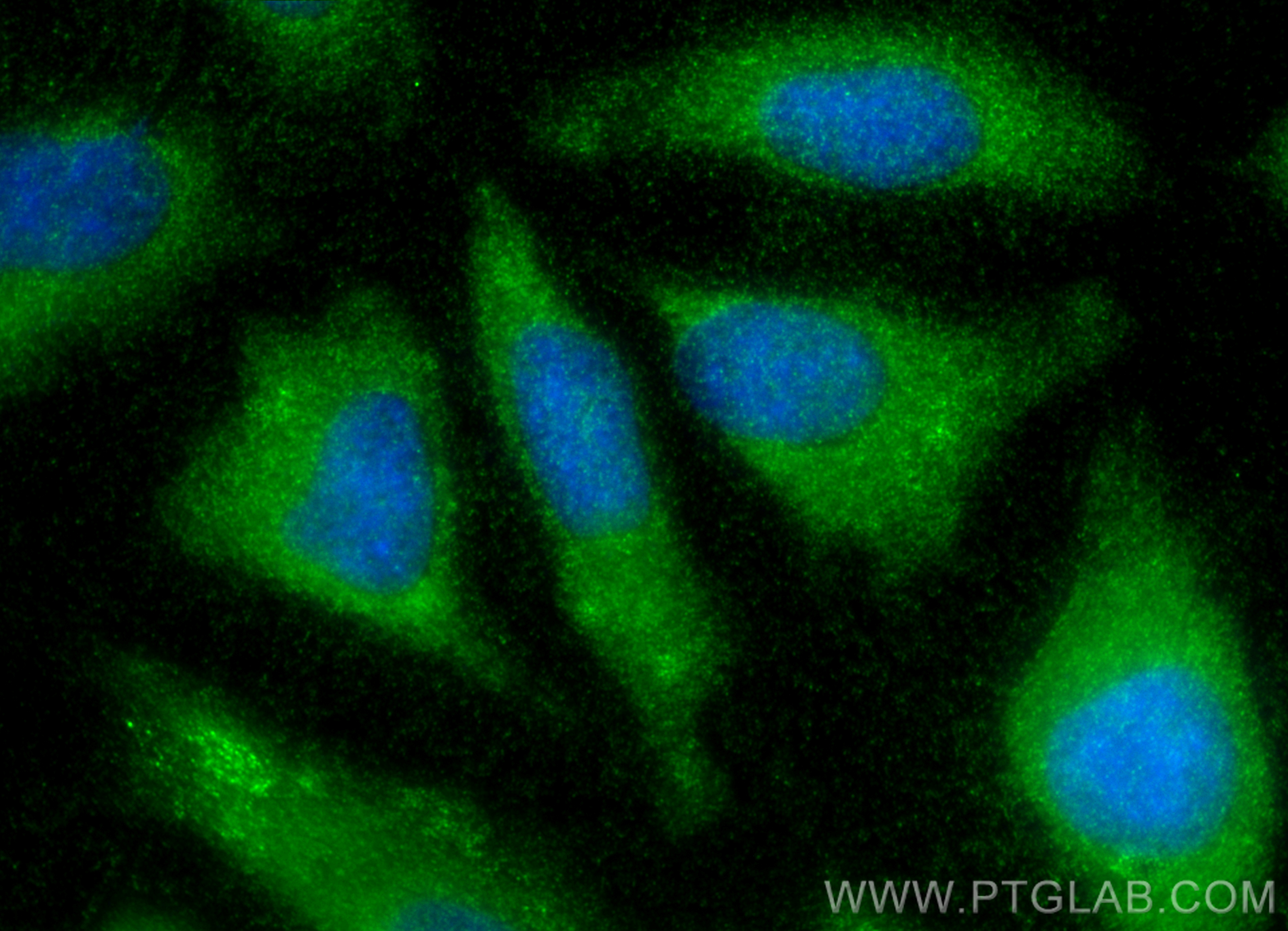 IF Staining of HeLa using 14366-1-AP