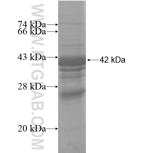 FAM176B fusion protein Ag14578 SDS-PAGE