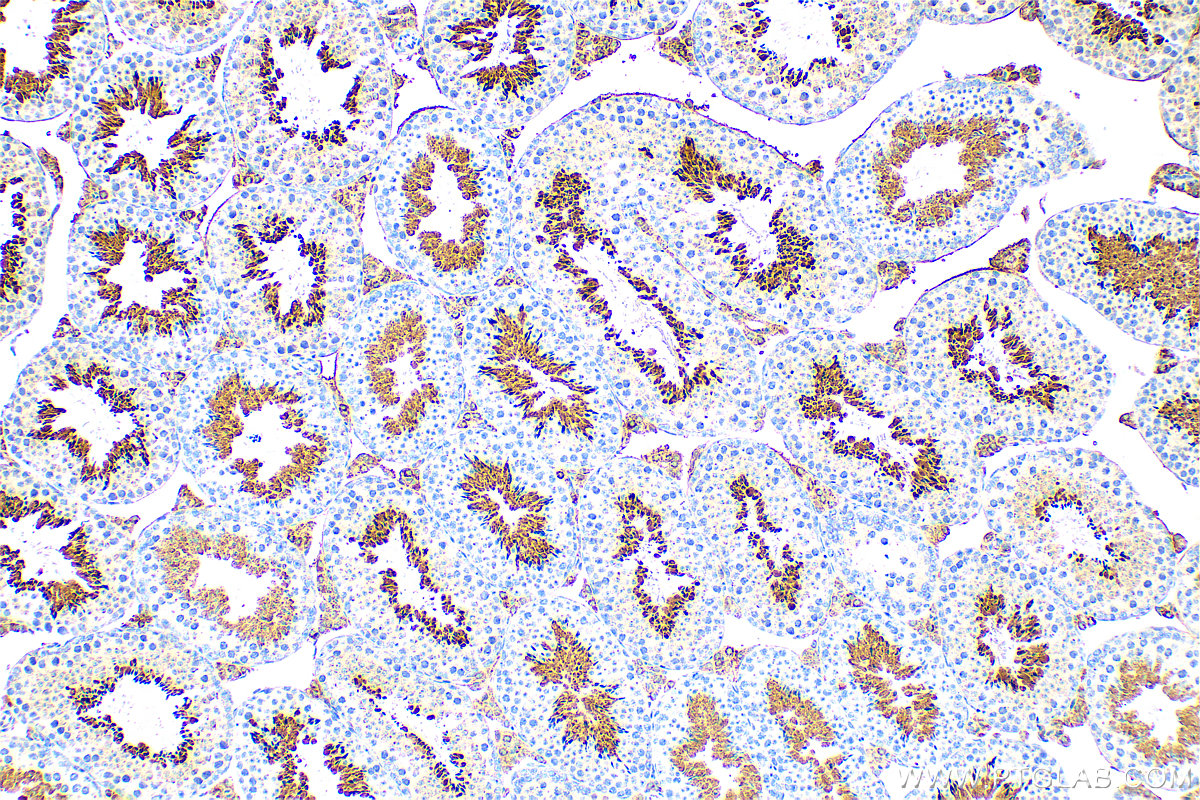 IHC staining of mouse testis using 26509-1-AP