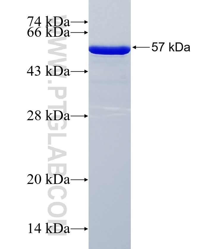 FAM184B fusion protein Ag35430 SDS-PAGE FAM184B fusion protein Ag35430 SDS-PAGE