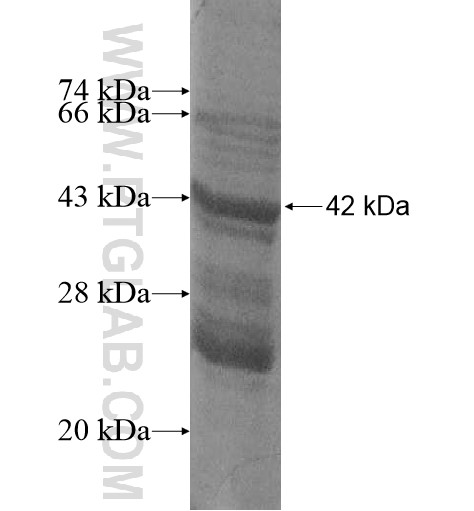 FAM185A fusion protein Ag15041 SDS-PAGE