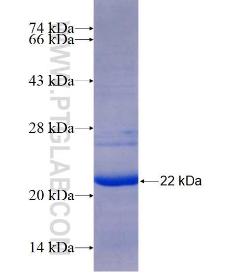 FAM185A fusion protein Ag15439 SDS-PAGE FAM185A fusion protein Ag15439 SDS-PAGE