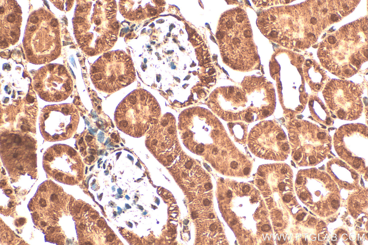 IHC staining of mouse kidney using 21078-1-AP