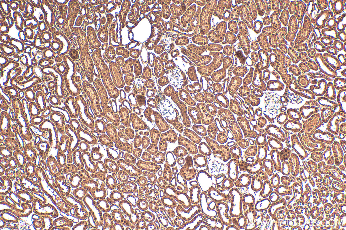 IHC staining of mouse kidney using 21078-1-AP
