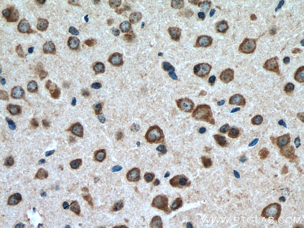 IHC staining of mouse brain using 13948-1-AP