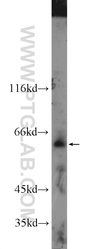 WB analysis of mouse lung using 25258-1-AP