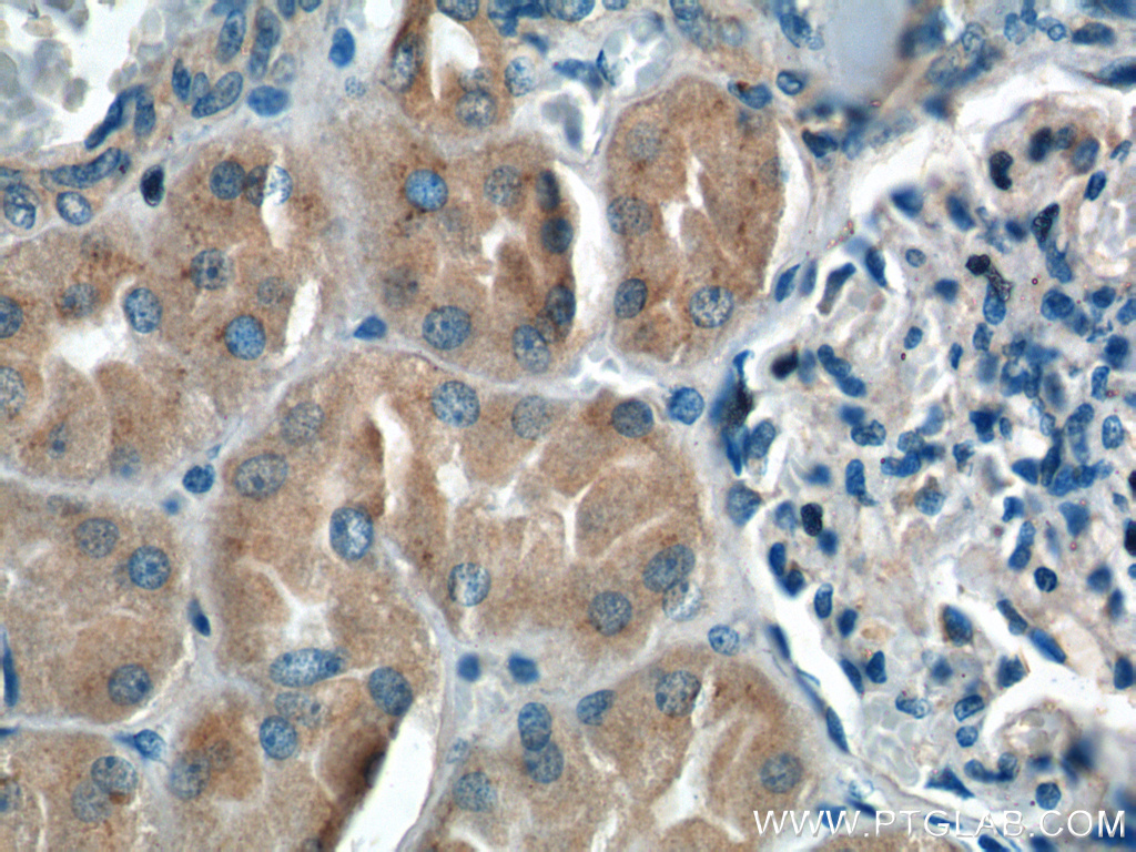 IHC staining of human kidney using 25395-1-AP
