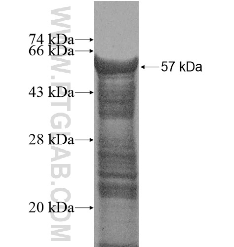 FAM21C fusion protein Ag14590 SDS-PAGE FAM21C fusion protein Ag14590 SDS-PAGE